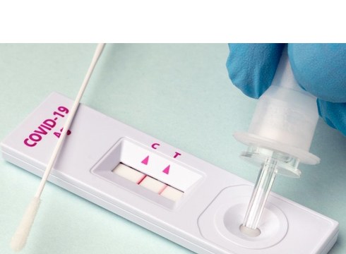 Antigeno probek 2,94 euro balioko dute gehienez