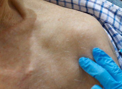 Aste honetan hasiko da Osakidetzan 90 urtetik gorakoen txertaketa