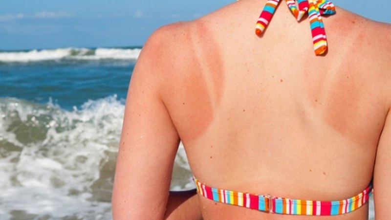 Azala eguzkitik nola babestu azaltzeko hitzaldia gaur ...eta kitto!-n