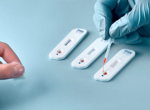 COVID-19a norberak detektatzeko testak aste honetan eskuratu ahal izango dira farmazietan