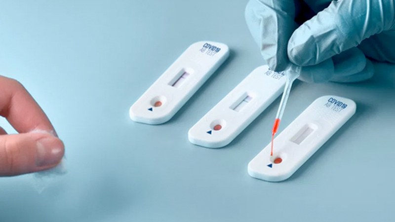 COVID-19a norberak detektatzeko testak aste honetan eskuratu ahal izango dira farmazietan