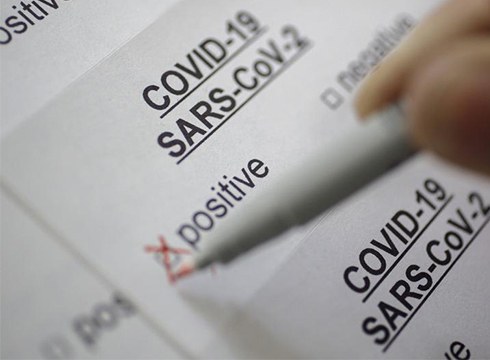 Euskadi eremu gorrian sartu da azken orduetako 1139 kasu berrirekin