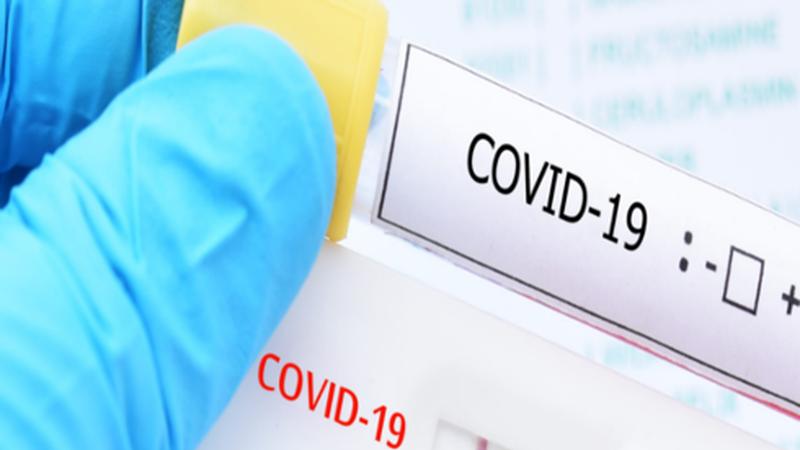 Koronabirus kasu berri bat atzeman dute Eibarren