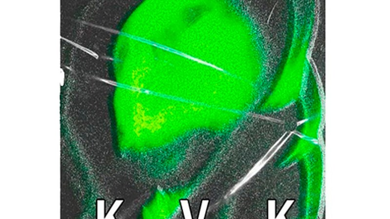 Kvalvikaren azken diskoa entzungai dago