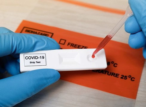 Medikuaren agiririk gabe saldu ahalko dira COVID-19a detektatzeko test azkarrak