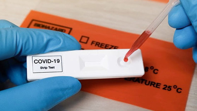 Medikuaren agiririk gabe saldu ahalko dira COVID-19a detektatzeko test azkarrak