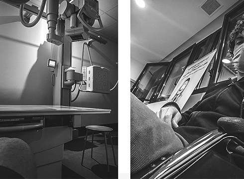 Pello Osorok istripu bat izan du eta neguko denboraldiari agur esan behar izan dio